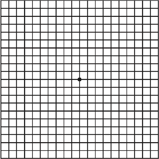 Amsler-Gitter-Test | Augenkompetenz Zentrum Bremerhaven